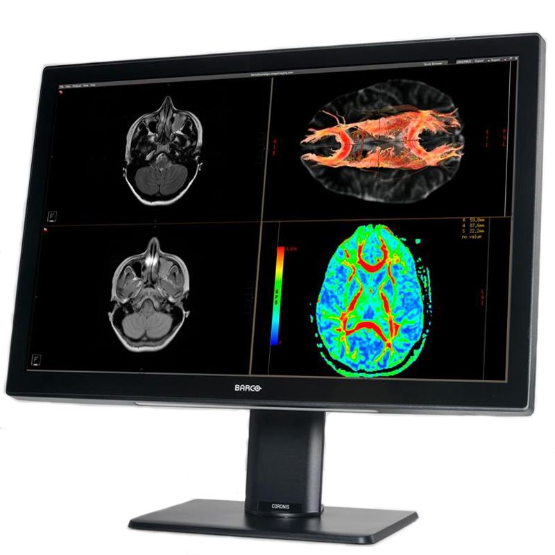 Медицинский монитор Barco Coronis Fusion 6MP MDCC-6530