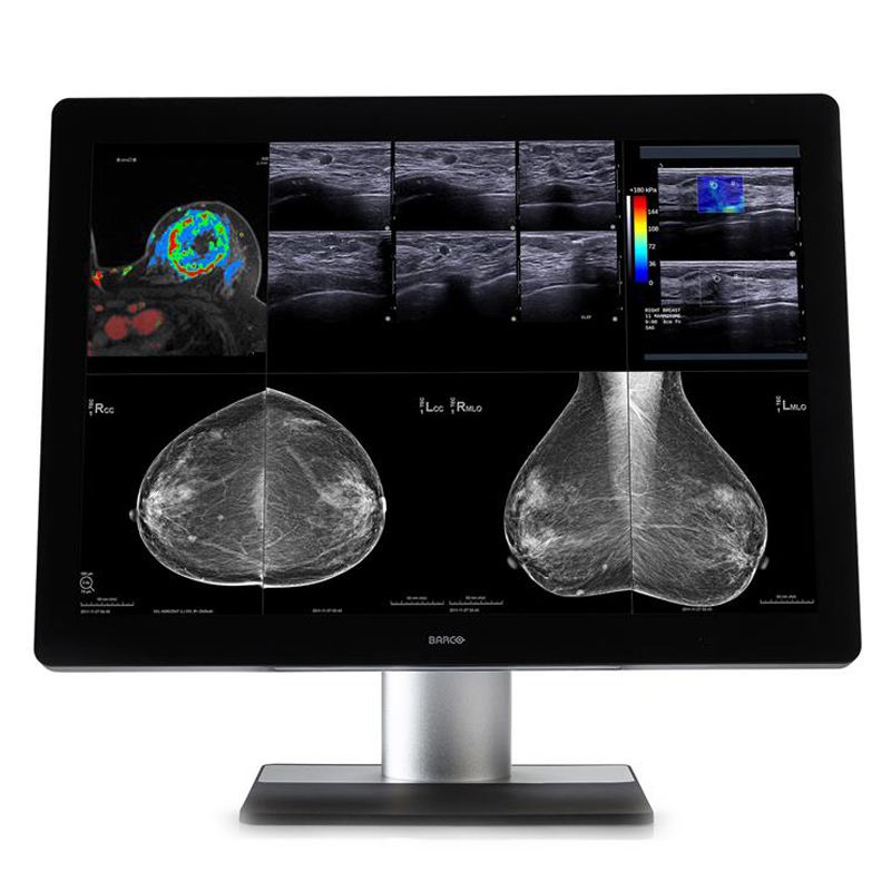 Медицинский монитор Barco Coronis Uniti MDMC-12133