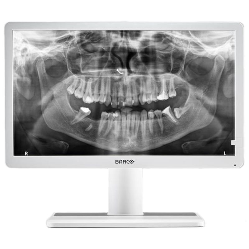 Медицинский монитор Barco Eonis 22' (MDRC-2222 Option WP) Dental
