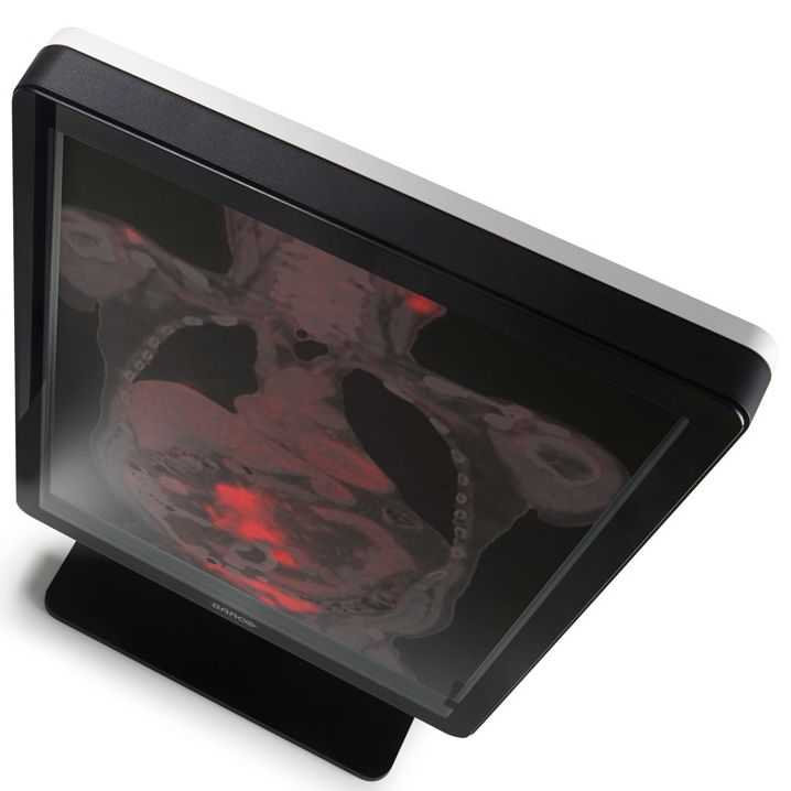Медицинский монитор Barco Nio Color 2MP LED MDNC-2221