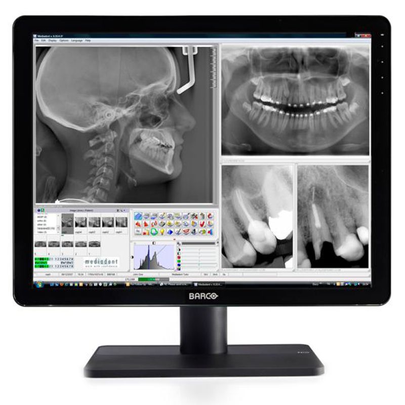 Медицинский монитор Barco Nio Color 3MP Dental