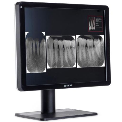 Медицинский монитор Barco Nio Color 3MP Dental