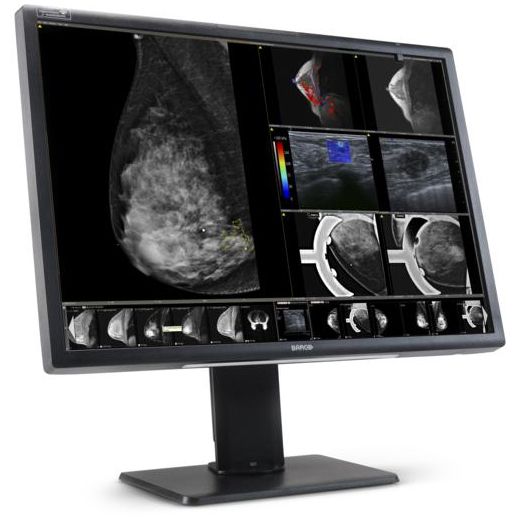 Медицинский монитор Barco Nio Fusion 12MP MDNC-12130